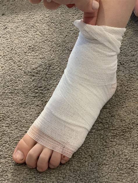 Ankle Sprains in Children — Kidzoles Orthotics for Kids