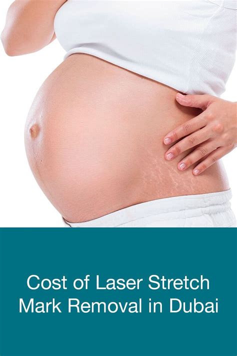 Cost of Laser Stretch Mark Removal in Dubai | Dubai Cosmetic Surgery®