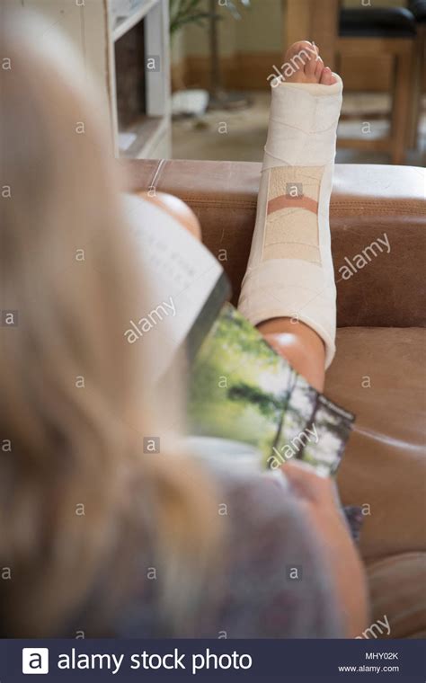 Plaster Cast Leg Stock Photos & Plaster Cast Leg Stock Images - Alamy