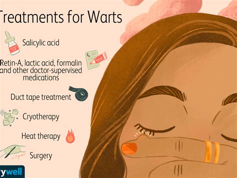 Can Warts Spread In Shower at Patricia Mack blog