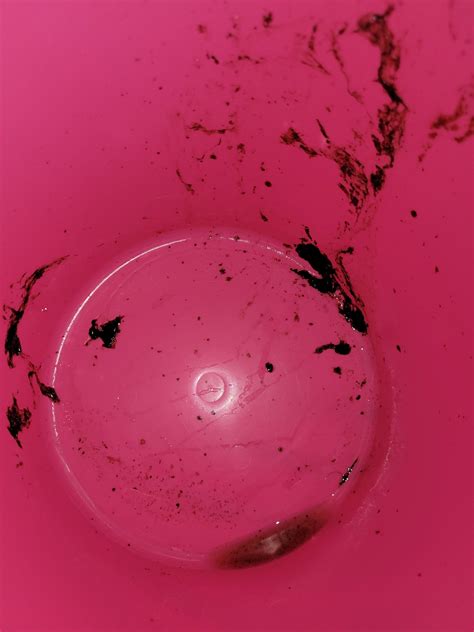 What Is Coffee Ground Vomit at Zoe Szabados blog