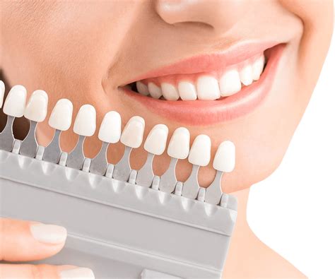 Bonding - Dentysta Gdynia