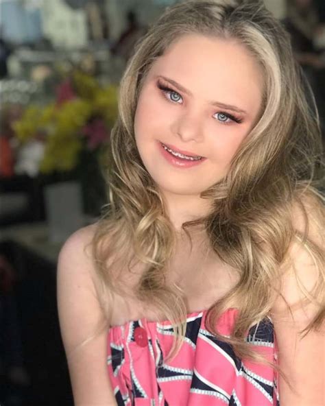 14-летняя девочка с синдромом Дауна стала успешной моделью