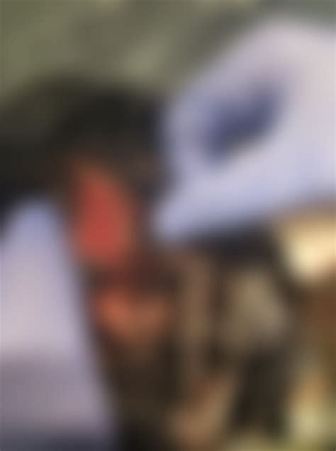 Busted my head open after falling off a scooter at 30mph. Also skinned