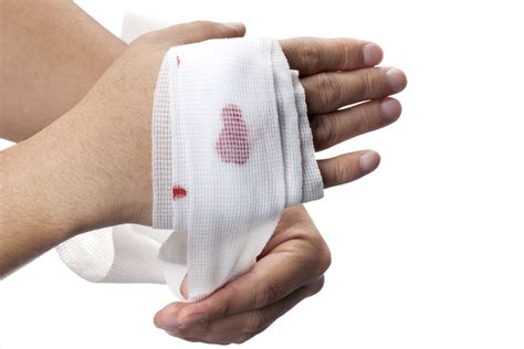 Engineered ‘Glue’ Called Growth Factors Helps Heal Wounds Faster