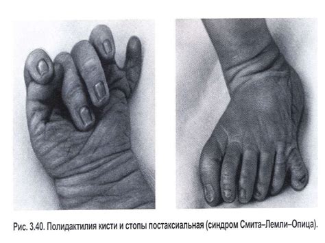 Жеке даму генетикасы - презентация онлайн