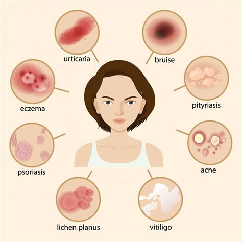 5 most common skin rashes and how to deal with them | Life-style News