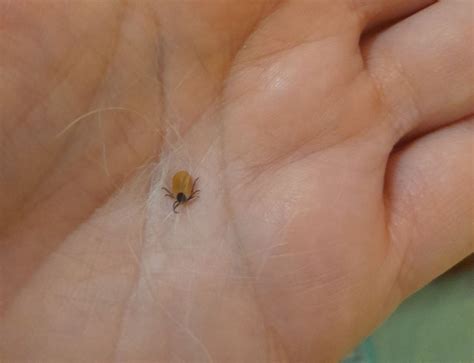 Можно ли умереть после укуса клеща, рассказали нижегородцам