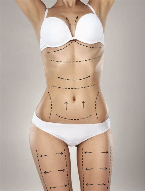 Liposuction/Fat Transfer | Natural Radiance Aesthetics & Wellness