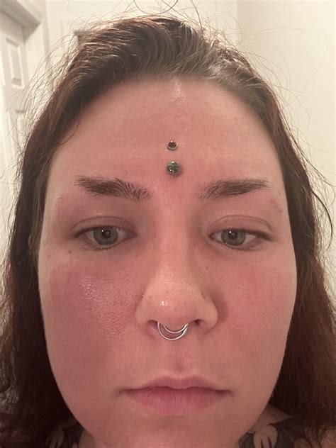 So my skin has been freaking out for who knows what reason for the past