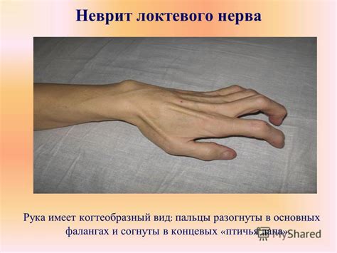 Презентация на тему: "Кафедра нервных болезней с курсом медицинской ...