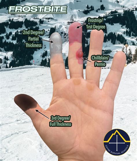 Meteorologists argue over why a 6 f cold snap happened now 1