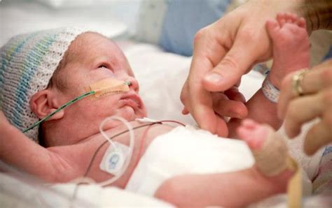 En Argentina, ocho de cada 100 bebés son prematuros - Primera Edición