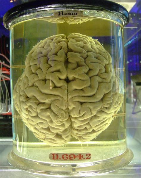 filehuman brain   vatjpg wikimedia commons