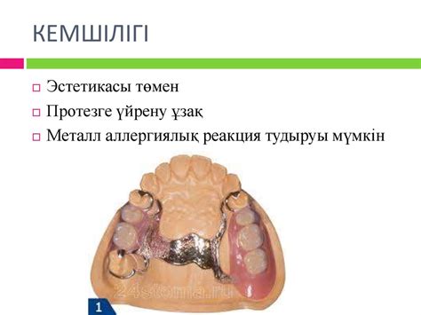 Доғалы протез - презентация онлайн