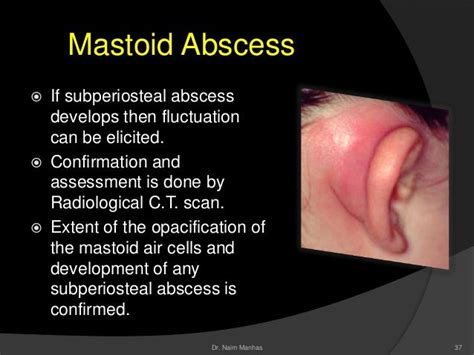 otolaryngological emergencies  neonateinfant  child