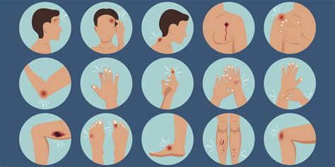 wound care coast  coast compounding