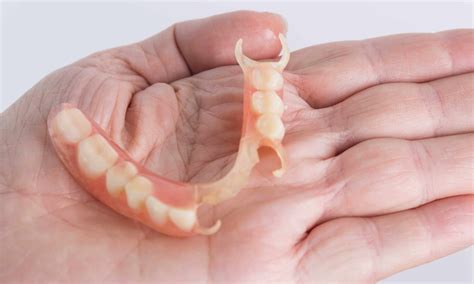 Flexi Partial Denture - Sydney Denture Clinic