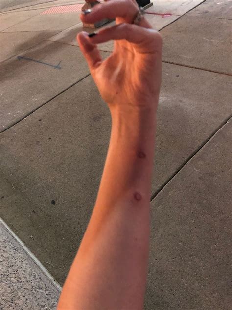 MLive photographer among journalists fired upon with pellets by Detroit