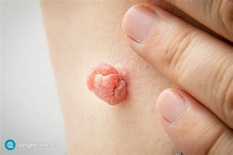 15 Skin Signs That Could Point to Liver Problems (Backed by Science