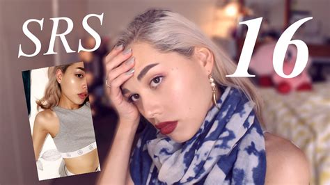 mtf  months  estrogen update srs rlgbt