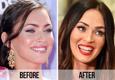 Hottest Women Celebrity's Shocking Transformation: Before & After Pics - 26snm0g