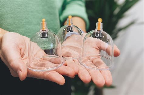 Cupping Therapy at The Physiotherapy Place