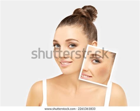 868 Pregnant Chloasma Images, Stock Photos, 3D objects, & Vectors ...