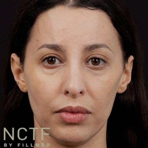 NCTF: Revitalize Your Skin with the Power Of 56 Nutrients