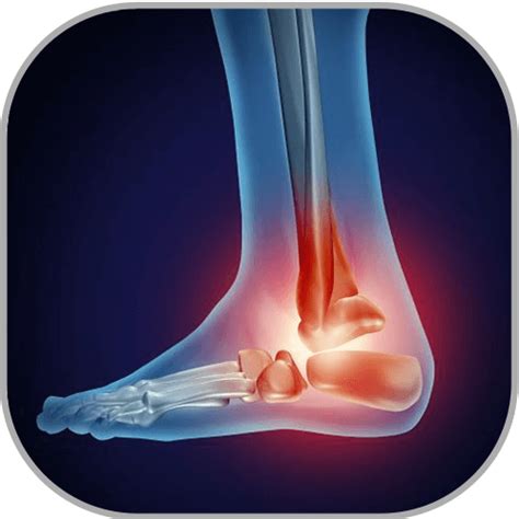 Ankle Sprains - Towson Orthopaedic Associates