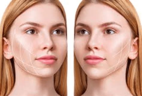 Which SMAS Technique is Best for Your Facelift Procedure? - Life in lines