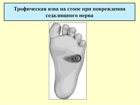 Спинномозговые нервы - презентация онлайн