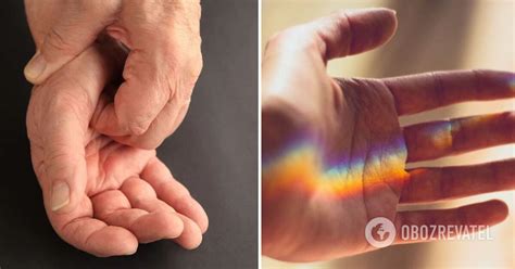 Why does the right and left hand itch: the essence of a well-known sign ...