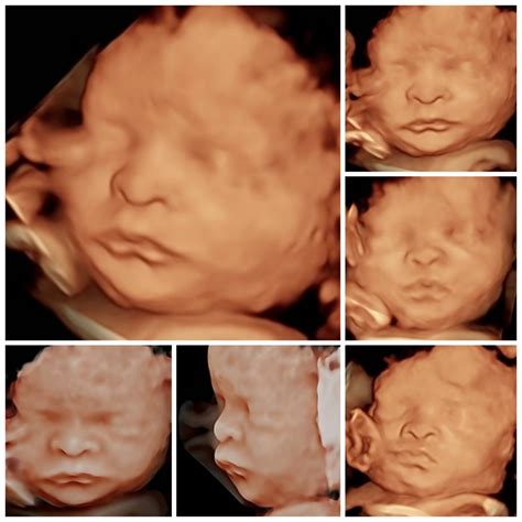 ULTRASOUND TECHNIQUES 3D BABY - Updated January 2025 - 10 Photos - 333 Crooks Ave, Clifton, New ...