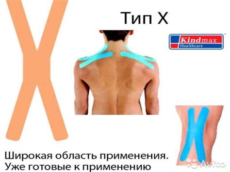 Кинезио тейпирование (Kinesio® Taping) - презентация онлайн