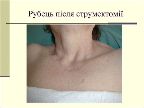 Зовнішній огляд хворого - презентация онлайн