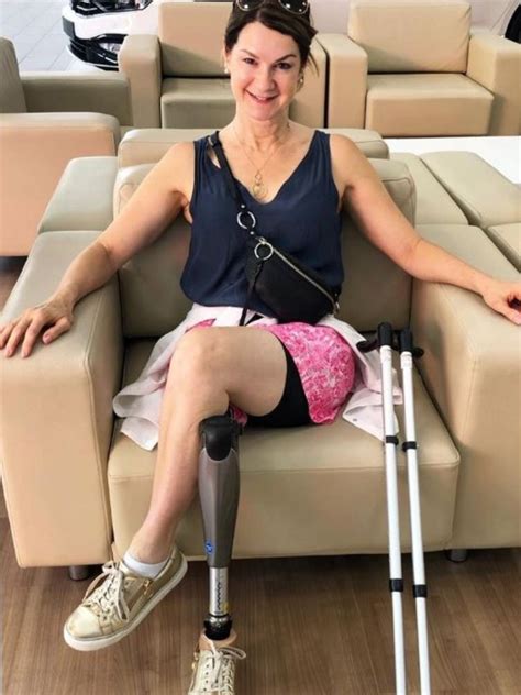 sydney womans rare cancer leads  full leg amputation newscomau
