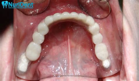 14 – Dr Nuri
