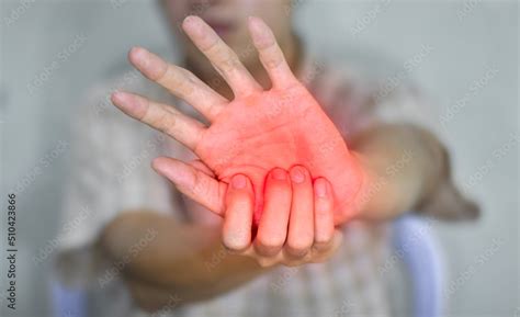 Painful palm of Asian man. Concept of compartment syndrome, cellulitis ...