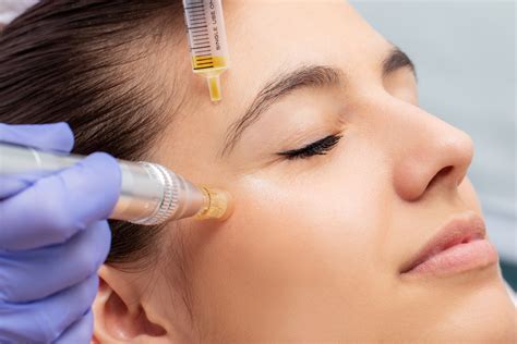 Platelet Rich Plasma -PRP - Aesthetic DnA