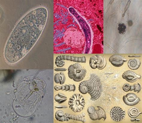 Eukaryotic Protists | Protists, Life science, Science