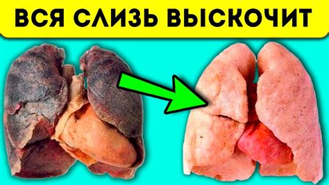 Как избавиться от кашля за 1 день!? Самые лучшие народные средства и ...