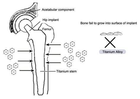 titanium alloys  orthopaedics intechopen