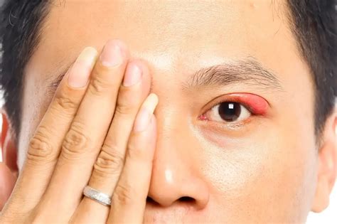 stye healthera order nhs prescriptions medicines