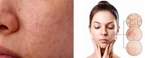 skin       maintain  skin