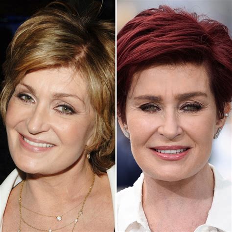 Celebrity Facelifts and Plastic Surgery: See Then-and-Now Pics | Life ...