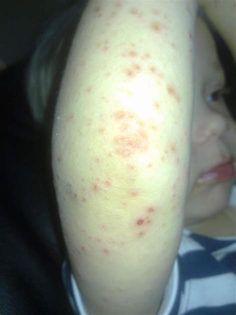 Allergisten poikien perheen elämää
