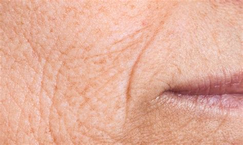 ageing skin cosmetic refinement clinic