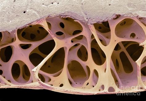 Bird Bone Tissue Photograph by Steve Gschmeissner/science Photo Library ...