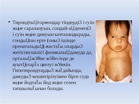 Кретинизм - презентация, доклад, проект скачать